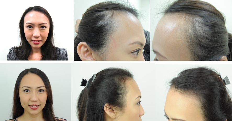 Case 2 · Jovita