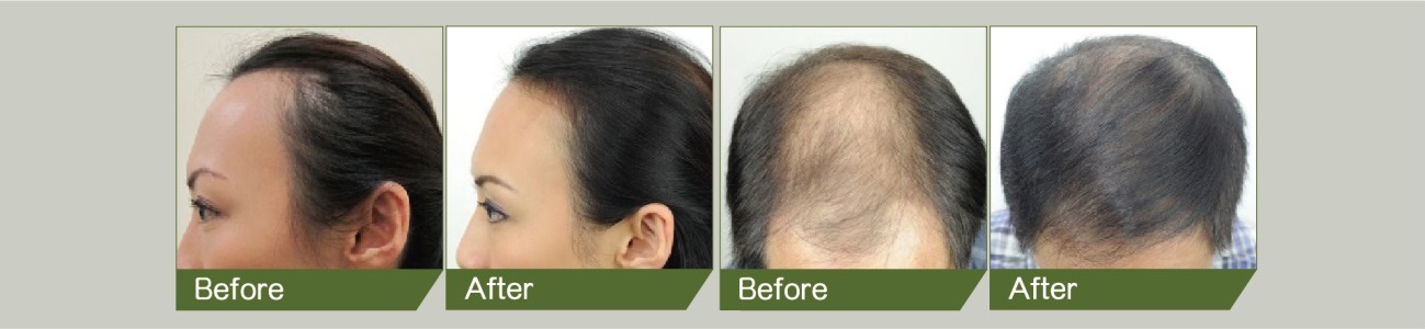 before-after-2